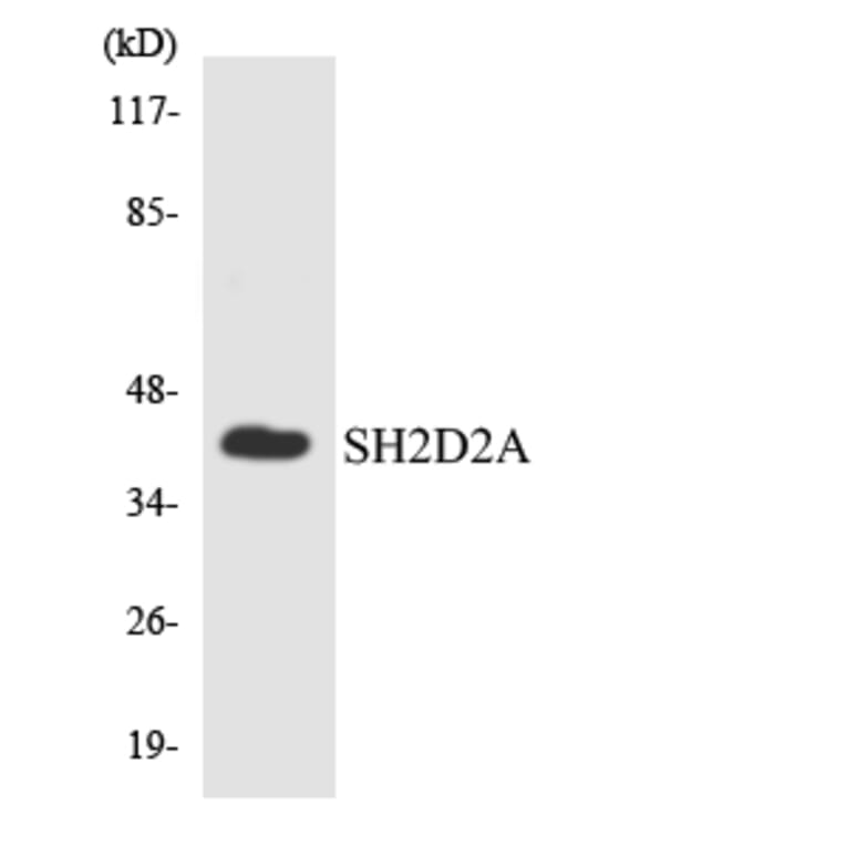 Western Blot - Anti-SH2D2A Antibody (R12-3502) - Antibodies.com