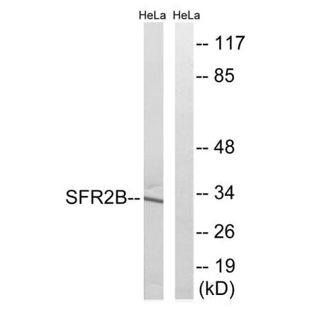 Western Blot - Anti-SFRS2B Antibody (C18938) - Antibodies.com