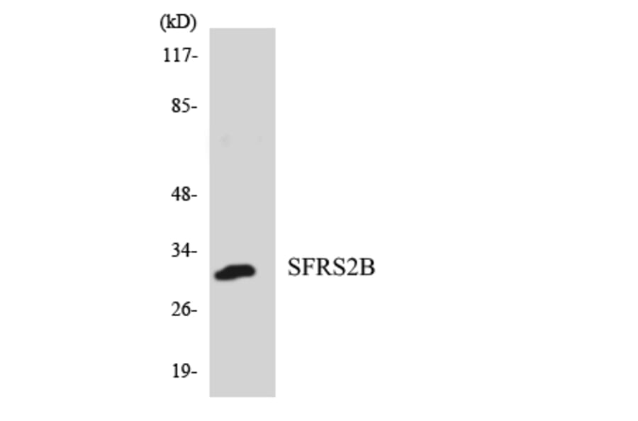 Western Blot - Anti-SFRS2B Antibody (R12-3498) - Antibodies.com