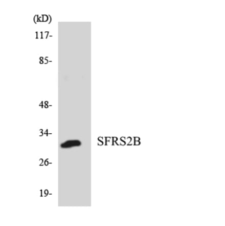 Western Blot - Anti-SFRS2B Antibody (R12-3498) - Antibodies.com
