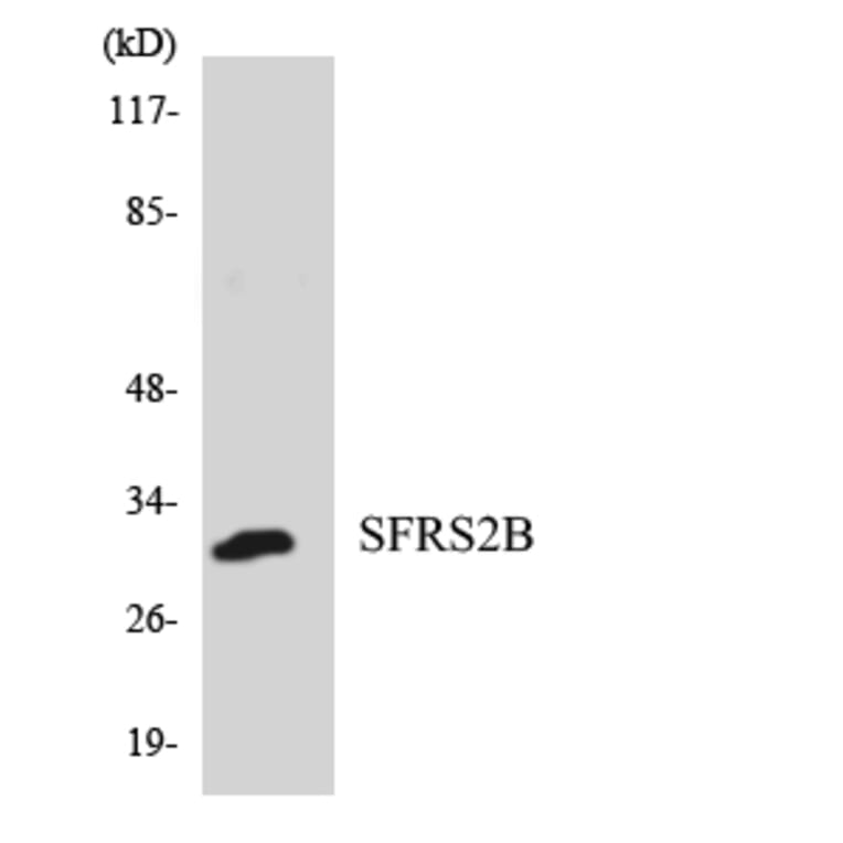 Western Blot - Anti-SFRS2B Antibody (R12-3498) - Antibodies.com