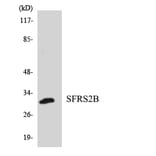 Western Blot - Anti-SFRS2B Antibody (R12-3498) - Antibodies.com