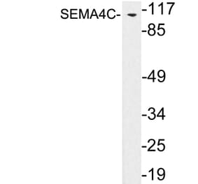 Western Blot - Anti-SEMA4C Antibody (R12-2354) - Antibodies.com