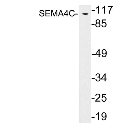 Western Blot - Anti-SEMA4C Antibody (R12-2354) - Antibodies.com