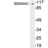 Western Blot - Anti-SEMA4C Antibody (R12-2354) - Antibodies.com