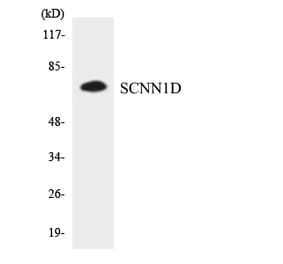 Western Blot - Anti-SCNN1D Antibody (R12-3484) - Antibodies.com
