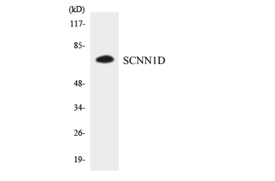 Western Blot - Anti-SCNN1D Antibody (R12-3484) - Antibodies.com