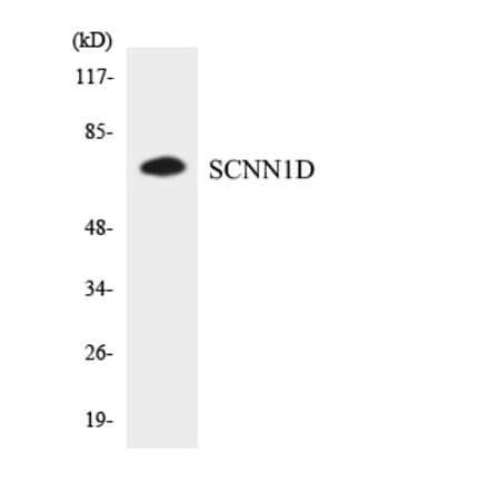 Western Blot - Anti-SCNN1D Antibody (R12-3484) - Antibodies.com