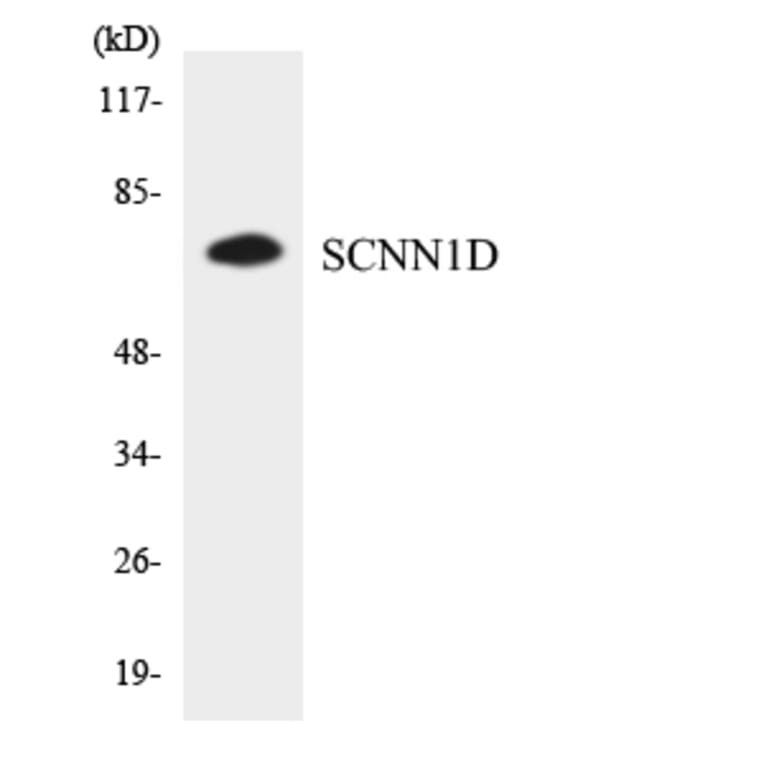 Western Blot - Anti-SCNN1D Antibody (R12-3484) - Antibodies.com