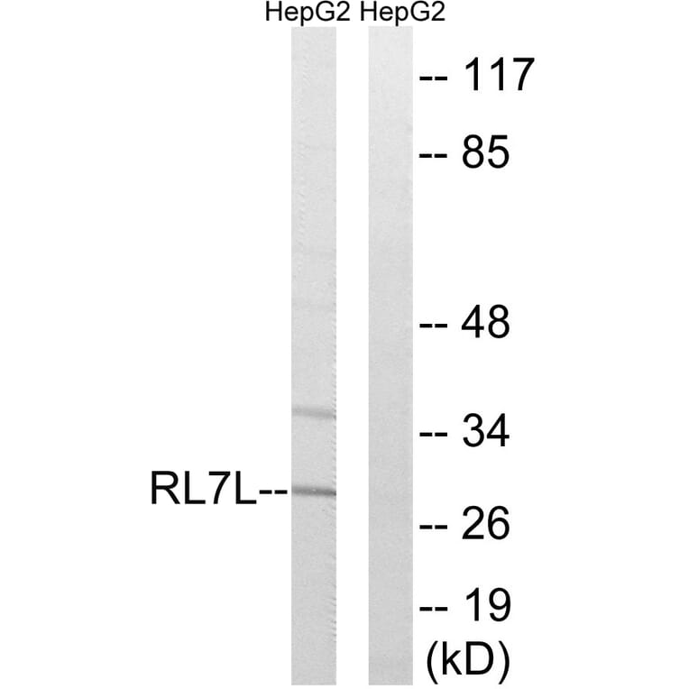 Western Blot - Anti-RPL7L1 Antibody (C18424) - Antibodies.com