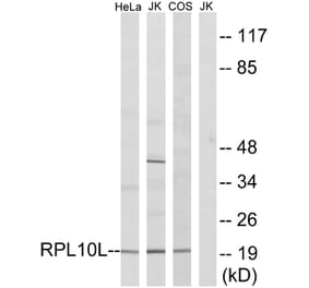Western Blot - Anti-RPL10L Antibody (C14146) - Antibodies.com