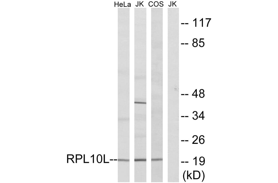 Western Blot - Anti-RPL10L Antibody (C14146) - Antibodies.com