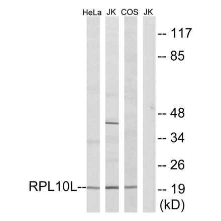 Western Blot - Anti-RPL10L Antibody (C14146) - Antibodies.com