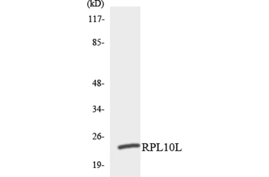 Western Blot - Anti-RPL10L Antibody (R12-3451) - Antibodies.com