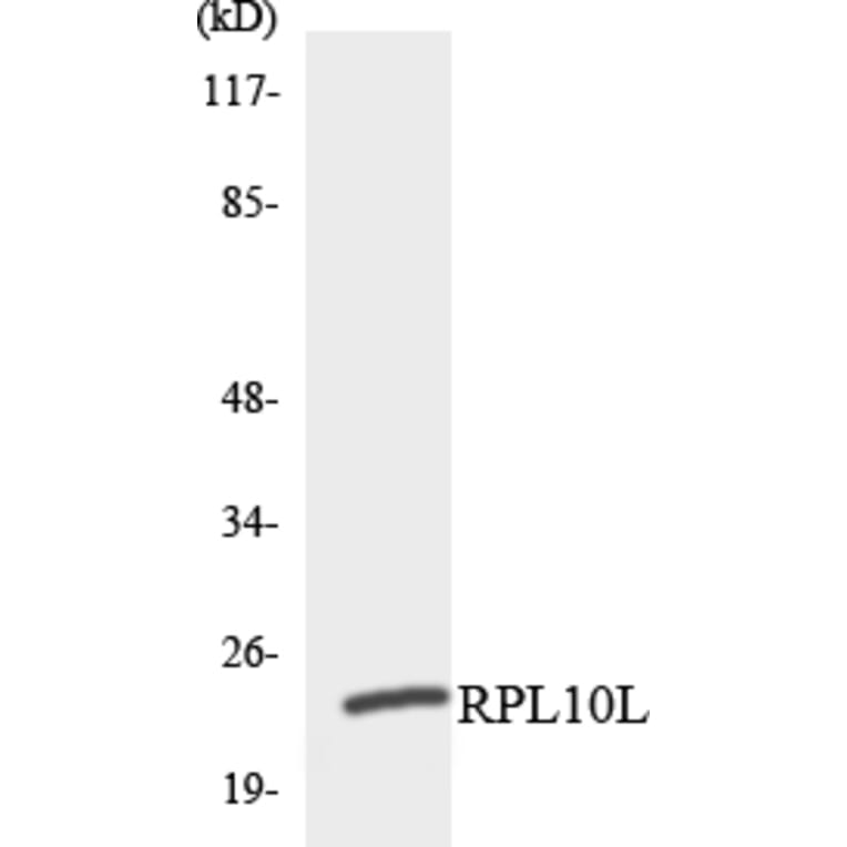 Western Blot - Anti-RPL10L Antibody (R12-3451) - Antibodies.com