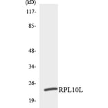 Western Blot - Anti-RPL10L Antibody (R12-3451) - Antibodies.com