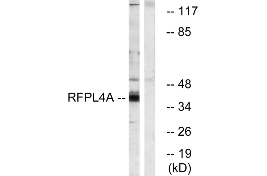 Western Blot - Anti-RFPL4A Antibody (C18339) - Antibodies.com