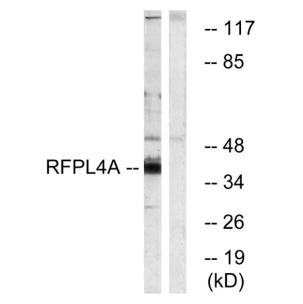 Western Blot - Anti-RFPL4A Antibody (C18339) - Antibodies.com