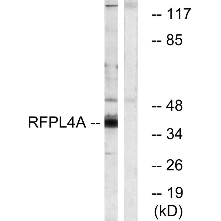 Western Blot - Anti-RFPL4A Antibody (C18339) - Antibodies.com