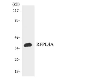 Western Blot - Anti-RFPL4A Antibody (R12-3426) - Antibodies.com