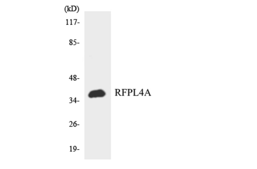 Western Blot - Anti-RFPL4A Antibody (R12-3426) - Antibodies.com