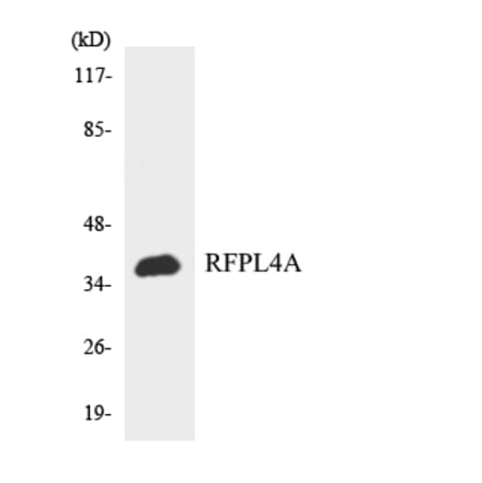 Western Blot - Anti-RFPL4A Antibody (R12-3426) - Antibodies.com