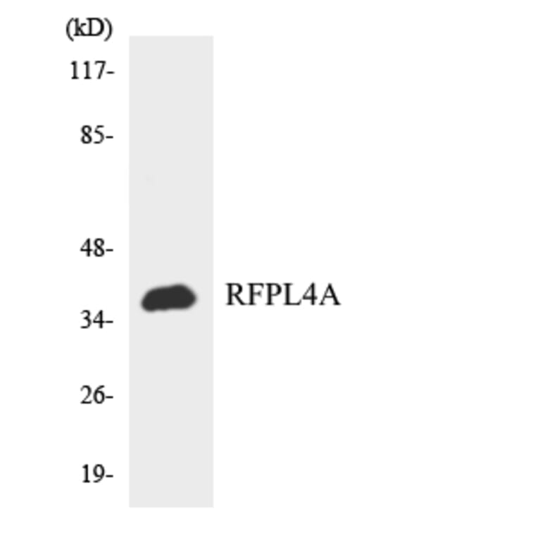 Western Blot - Anti-RFPL4A Antibody (R12-3426) - Antibodies.com