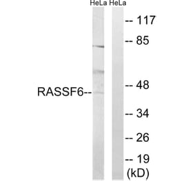 Western Blot - Anti-RASSF6 Antibody (C18183) - Antibodies.com