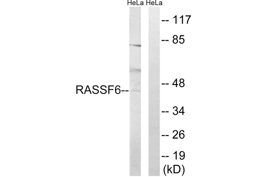 Western Blot - Anti-RASSF6 Antibody (C18183) - Antibodies.com