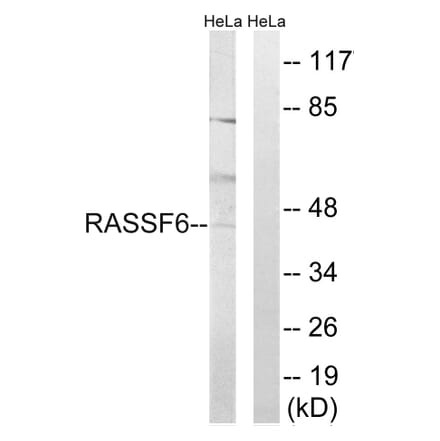 Western Blot - Anti-RASSF6 Antibody (C18183) - Antibodies.com