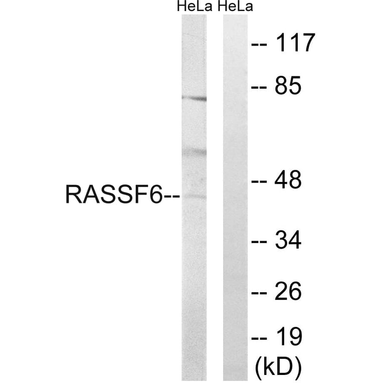 Western Blot - Anti-RASSF6 Antibody (C18183) - Antibodies.com