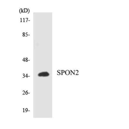 Western Blot - Anti-RASSF6 Antibody (R12-3411) - Antibodies.com