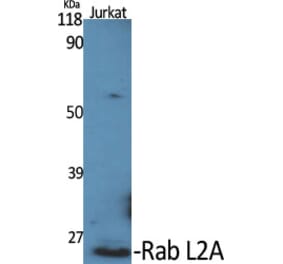Western Blot - Anti-RABL2A Antibody (C18132) - Antibodies.com
