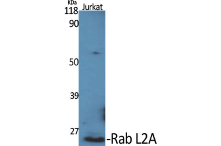 Western Blot - Anti-RABL2A Antibody (C18132) - Antibodies.com