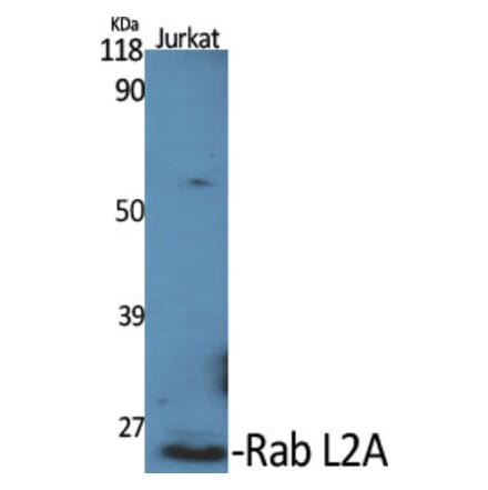 Western Blot - Anti-RABL2A Antibody (C18132) - Antibodies.com
