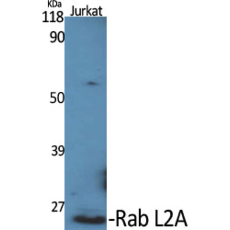 Western Blot - Anti-RABL2A Antibody (C18132) - Antibodies.com