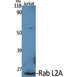 Western Blot - Anti-RABL2A Antibody (C18132) - Antibodies.com
