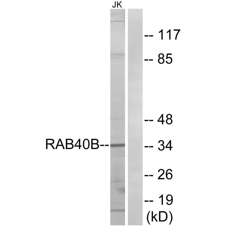 Western Blot - Anti-RAB40B Antibody (C18257) - Antibodies.com