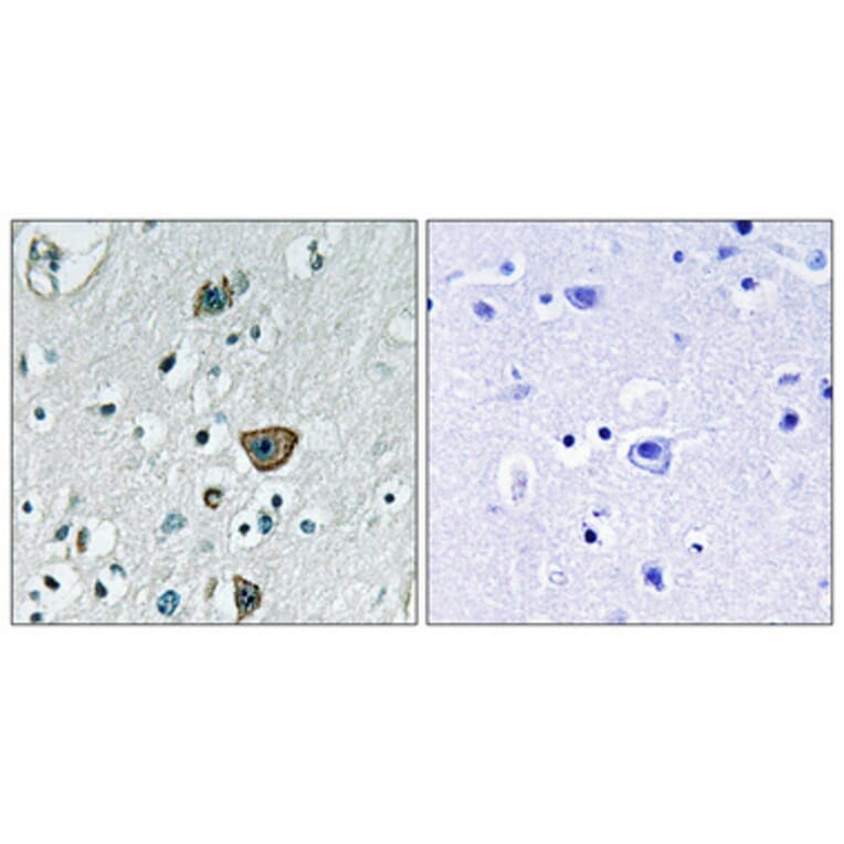 Immunohistochemistry - Anti-RAB40B Antibody (C18257) - Antibodies.com