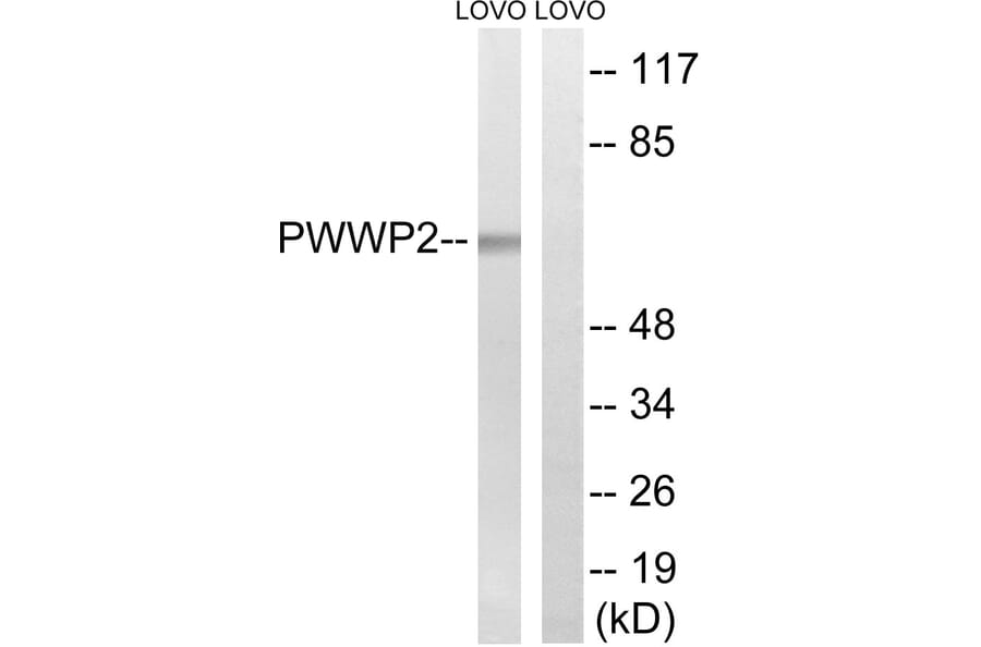 Western Blot - Anti-PWWP2B Antibody (C18097) - Antibodies.com