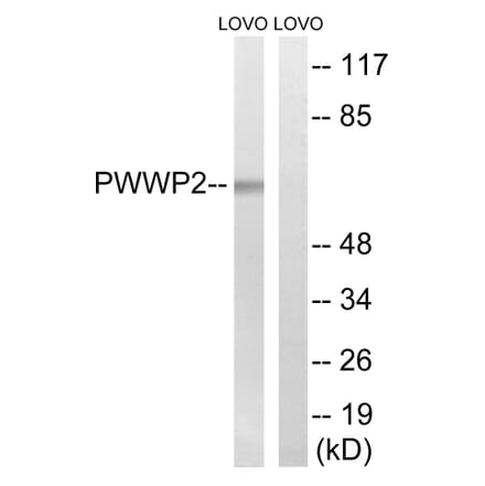 Western Blot - Anti-PWWP2B Antibody (C18097) - Antibodies.com