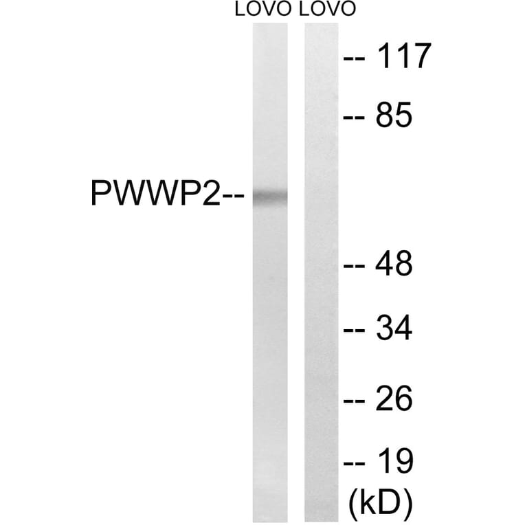 Western Blot - Anti-PWWP2B Antibody (C18097) - Antibodies.com
