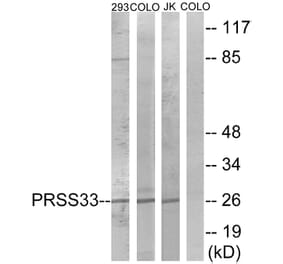 Western Blot - Anti-PRSS33 Antibody (C18518) - Antibodies.com