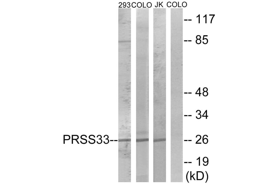 Western Blot - Anti-PRSS33 Antibody (C18518) - Antibodies.com