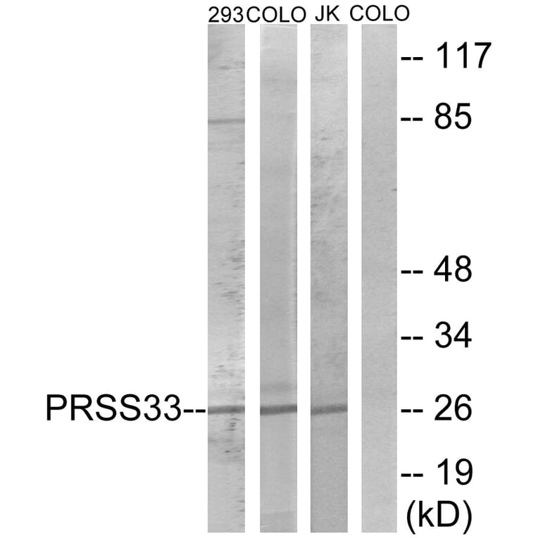 Western Blot - Anti-PRSS33 Antibody (C18518) - Antibodies.com