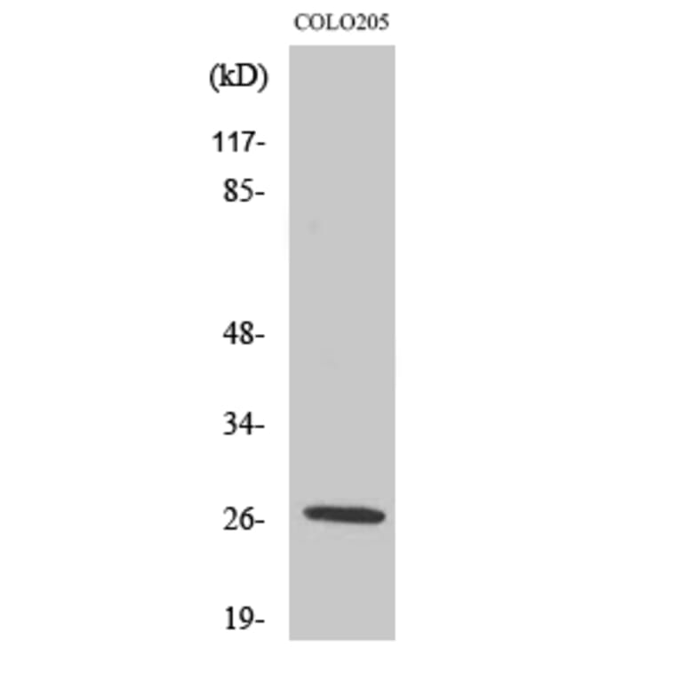 Western Blot - Anti-PRSS33 Antibody (C18518) - Antibodies.com