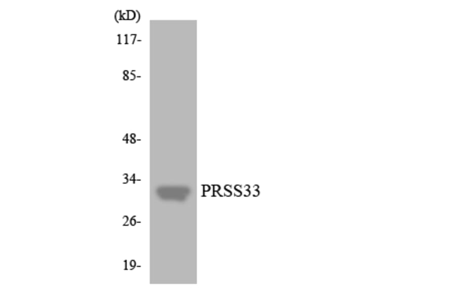 Western Blot - Anti-PRSS33 Antibody (R12-3375) - Antibodies.com