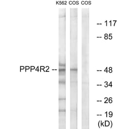 Western Blot - Anti-PPP4R2 Antibody (C18662) - Antibodies.com