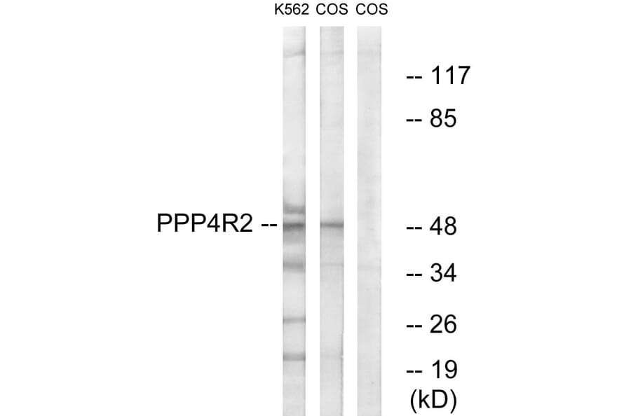 Western Blot - Anti-PPP4R2 Antibody (C18662) - Antibodies.com