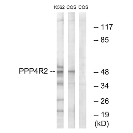 Western Blot - Anti-PPP4R2 Antibody (C18662) - Antibodies.com